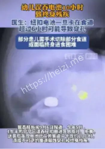 幼儿误吞电池